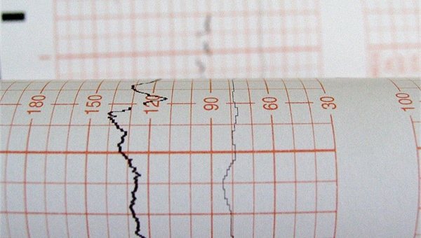 Tomsk Company developed the smallest electrocardiograph in the world