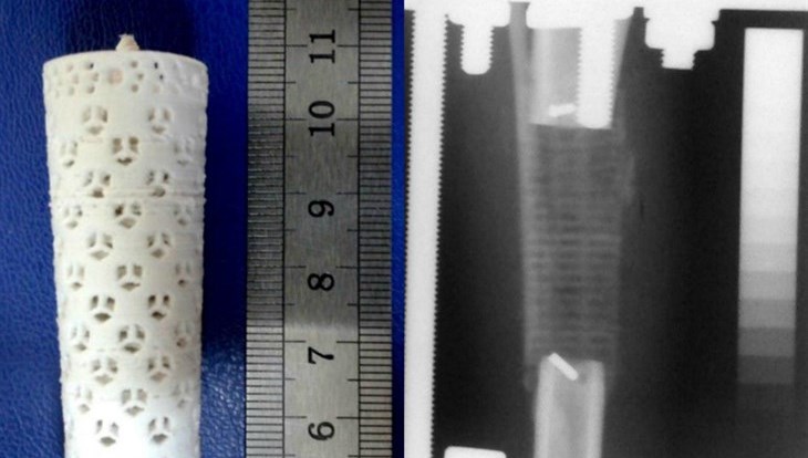 Напечатать кость: ученые ТПУ приручают композиты для имплантологии
